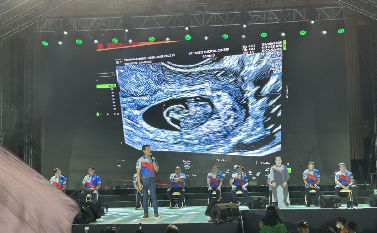 Musician-lawyer and Partido Demokratiko Pilipino (PDP) senatorial candidate Jimmy Bondoc reveals at the party’s miting de avance at the Liwasang Bonifacio in Manila on Thursday, May 8, 2025, that his wife, lawyer Isabel Torrijos, is 10 weeks pregnant, showing a photo of an ultrasound.