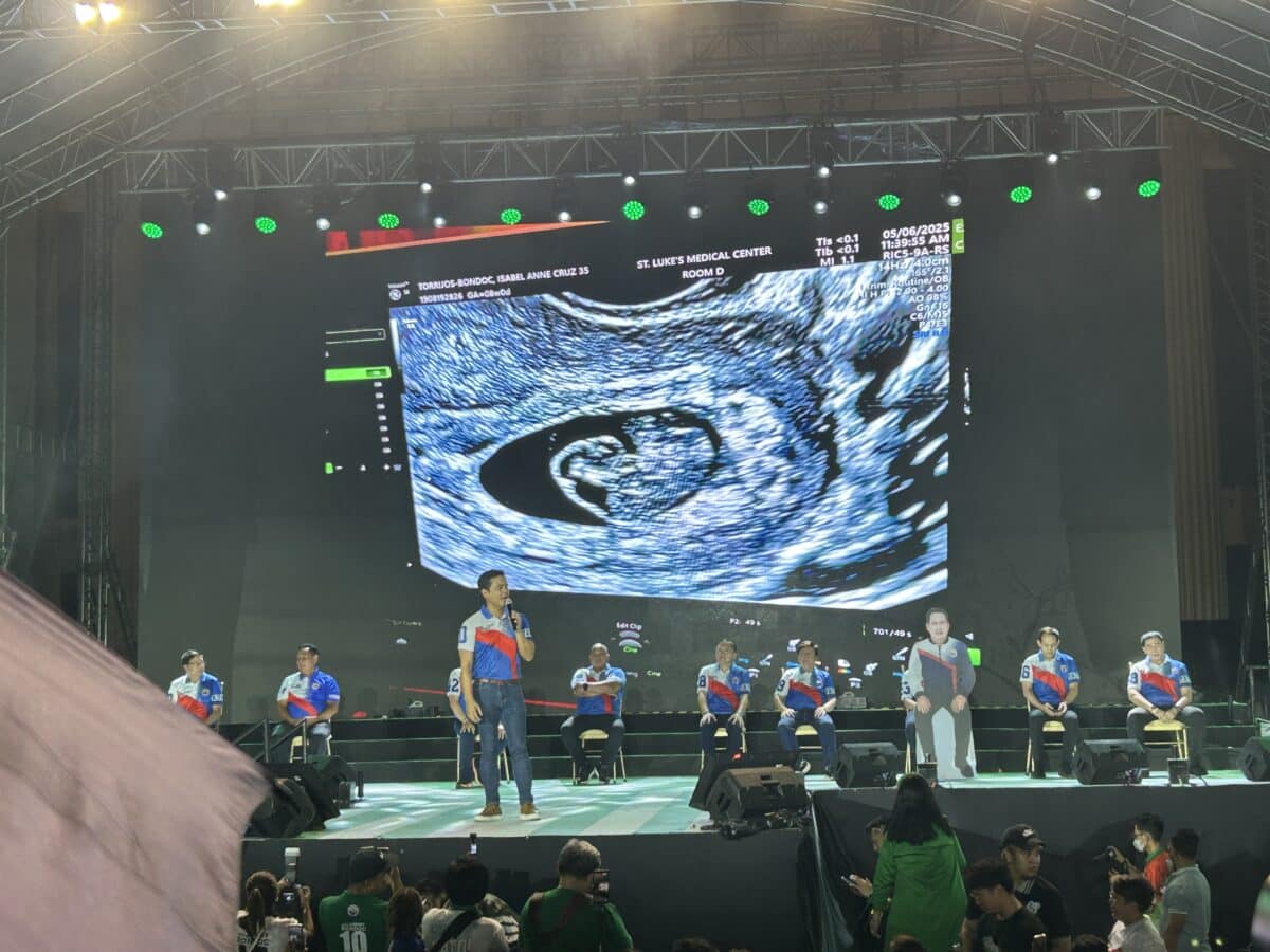 Musician-lawyer and Partido Demokratiko Pilipino (PDP) senatorial candidate Jimmy Bondoc reveals at the party’s miting de avance at the Liwasang Bonifacio in Manila on Thursday, May 8, 2025, that his wife, lawyer Isabel Torrijos, is 10 weeks pregnant, showing a photo of an ultrasound. INQUIRER.net / JASON SIGALES